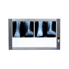 X-ray Film Viewer